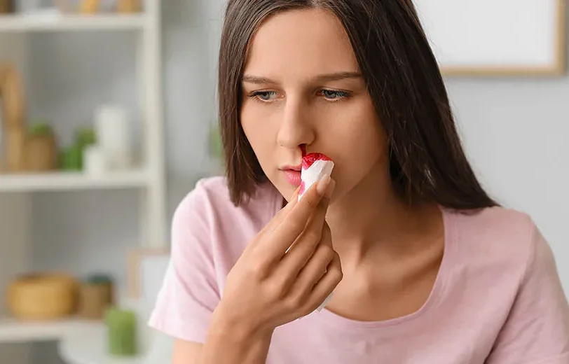 Как применять комбинированный способ остановки носового кровотечения
