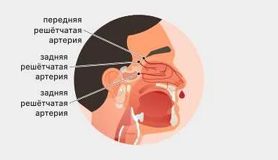 Какие методы использовать при рецидивирующем кровотечении из носа?