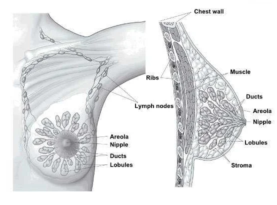 Стадии развития рака молочной железы и их характеристики