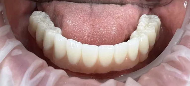 Вред для здоровья полости рта