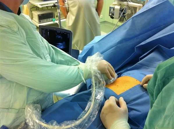 Важность оральной хирургии