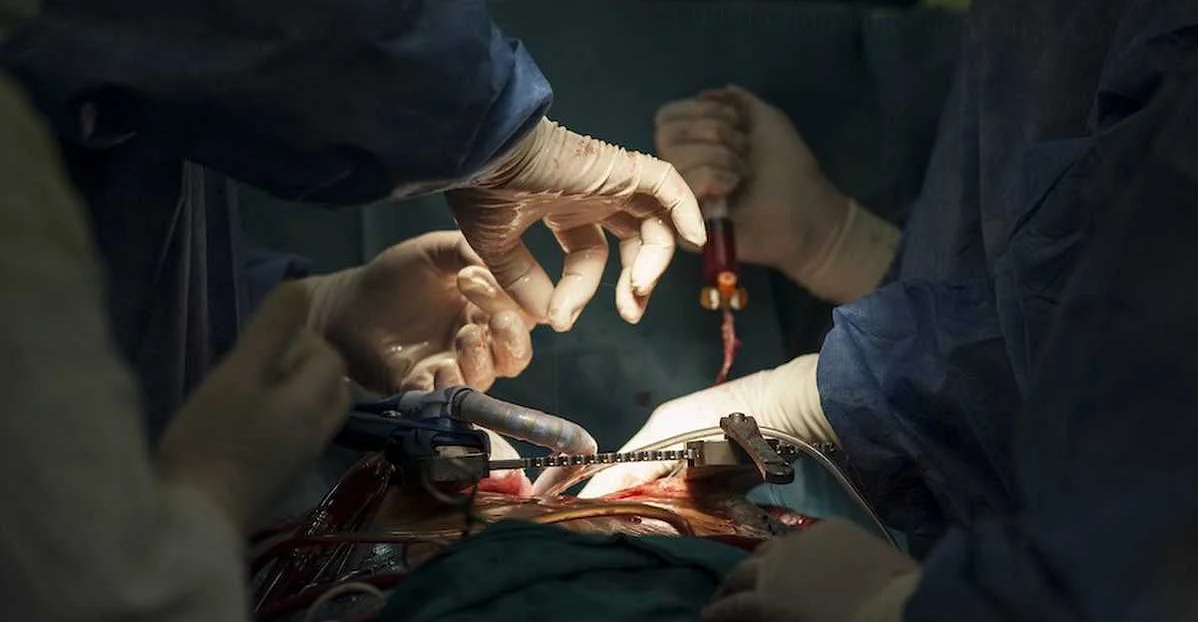 Миф 1: Все процедуры оральной хирургии очень болезненные
