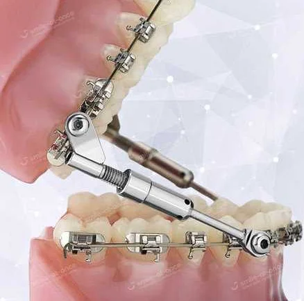 Новые технологии в области ортодонтии