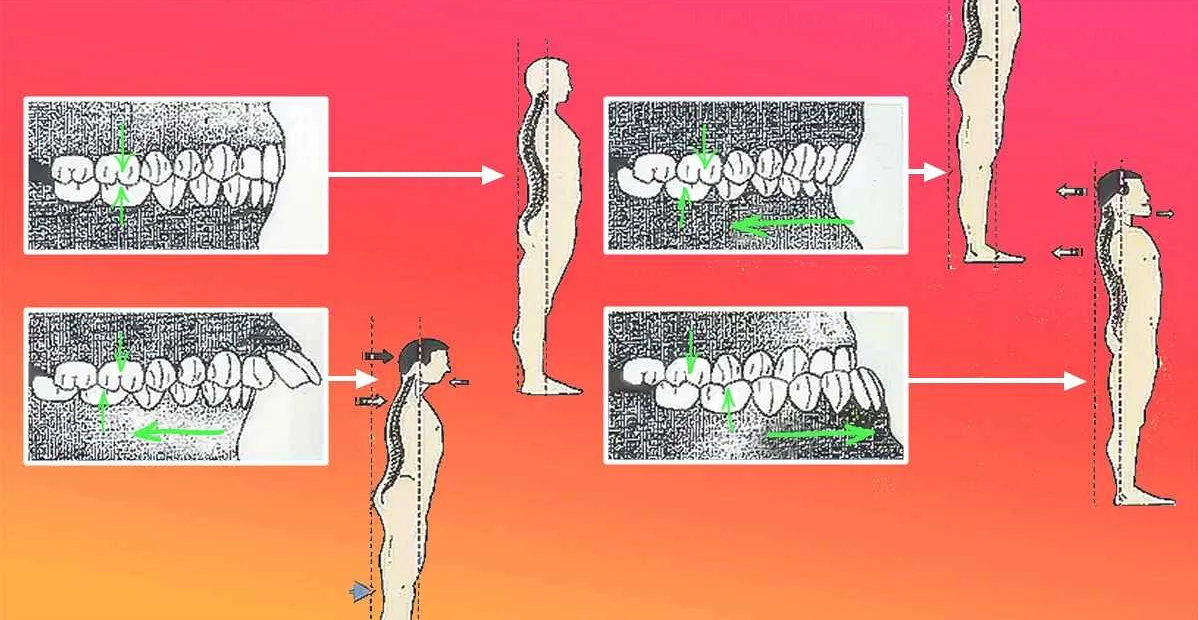 Ортодонтия и здоровье: выравнивание зубов и общее физическое состояние