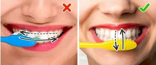 Ошибки в уходе за зубными протезами