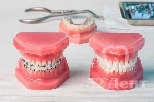 Съемные ортодонтические аппараты
