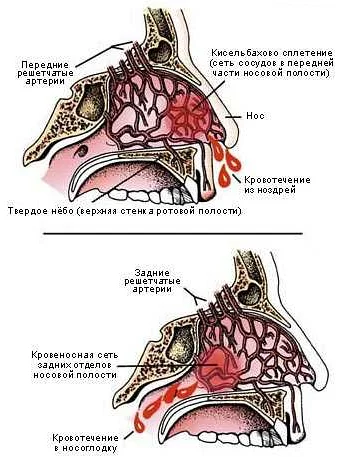Структура носа, влияющая на частоту кровотечений