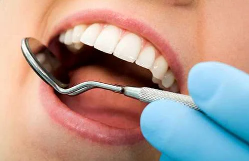 Виды процедур эстетической стоматологии
