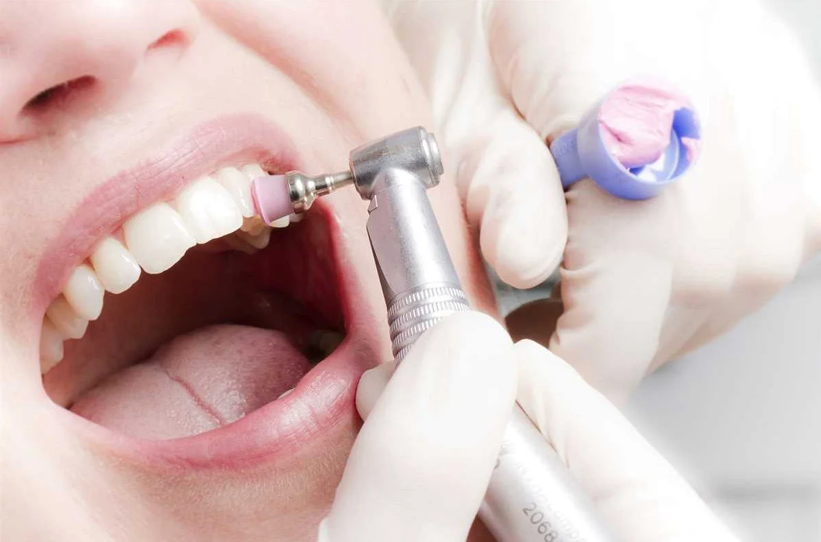 Ортодонтические аппараты и их влияние на чистоту зубов