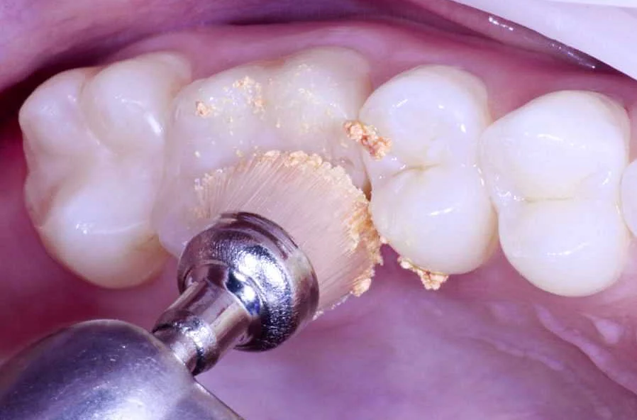 Teeth-cleaning: Стоматология и Общее Здоровье