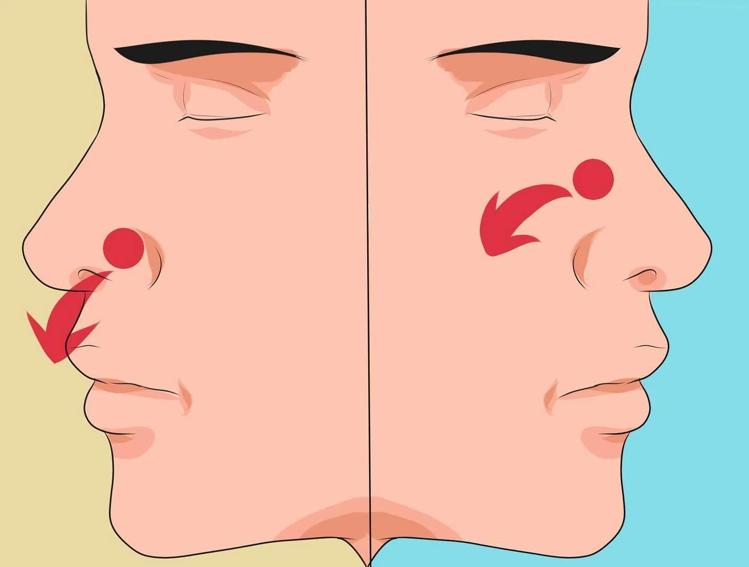 Возможные осложнения от носового кровотечения и головокружения