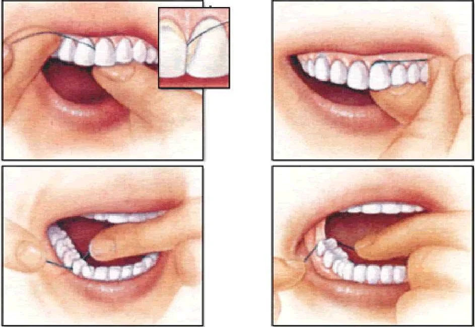 Основные ошибки при использовании зубной нити