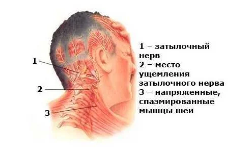 Медикаментозное лечение боли в правой части шеи