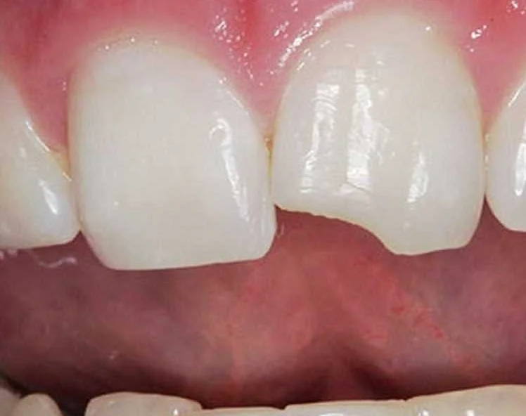 Значение травматологии в стоматологии и общем здоровье