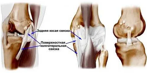 Как предотвратить повреждение связок колена