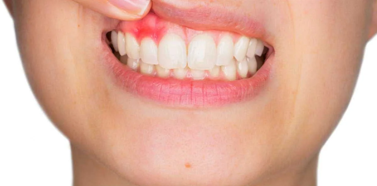 Аномалии ротовой полости и зубной системы