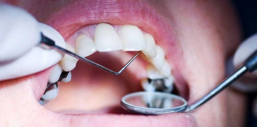 Важность профилактики кариеса в детской стоматологии