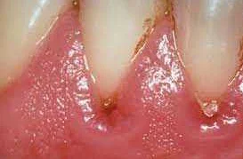 Гигиена полости рта: правила и средства для ухода за зубами и деснами