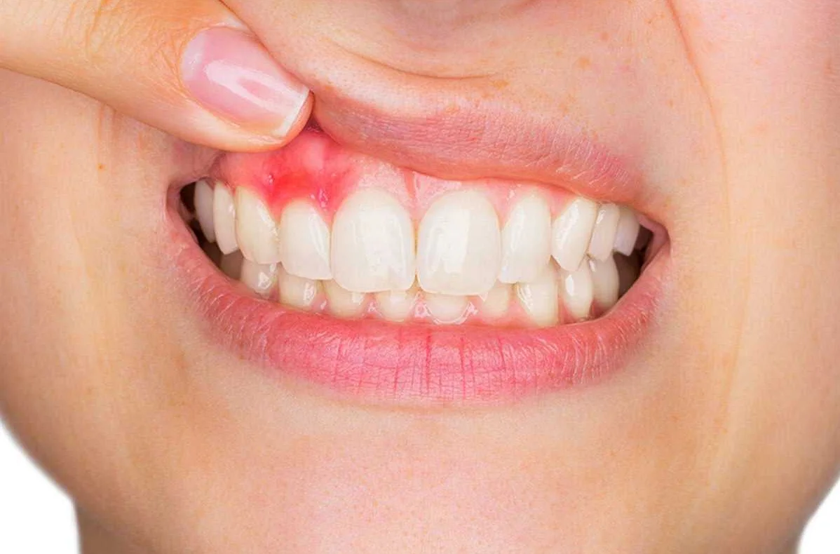 Влияние жесткой зубной щетки на полость рта