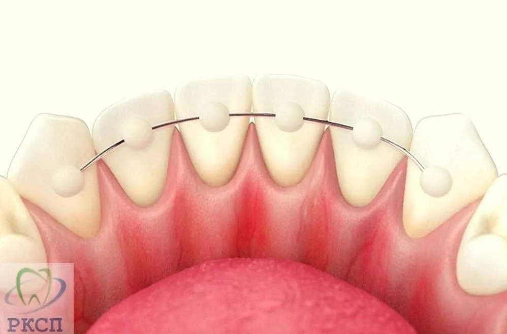 4. Регулярные посещения стоматолога