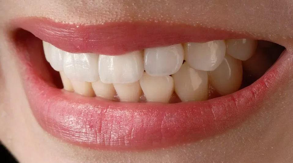 Рекомендации по уходу за восстановленными зубами