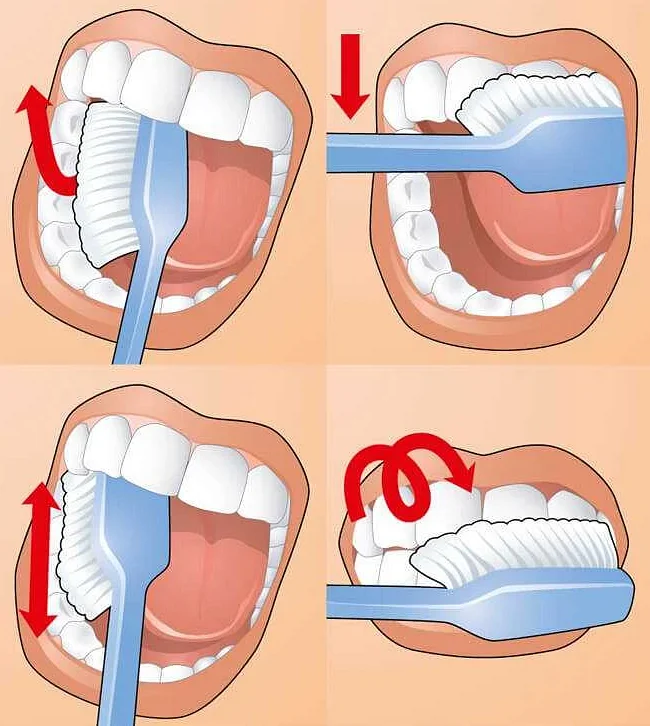 Чистка зубов: ключ к предотвращению проблем