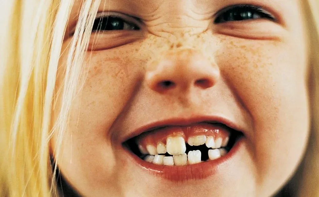 Роль здоровых зубов в общем здоровье организма