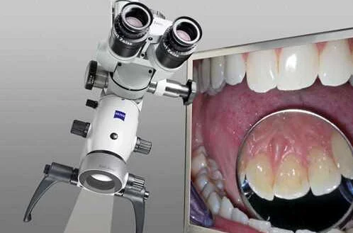 Почему стоит выбрать стоматологическую эндодонтию
