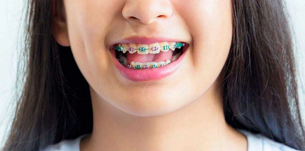 Продвижение стоматологических услуг для детей