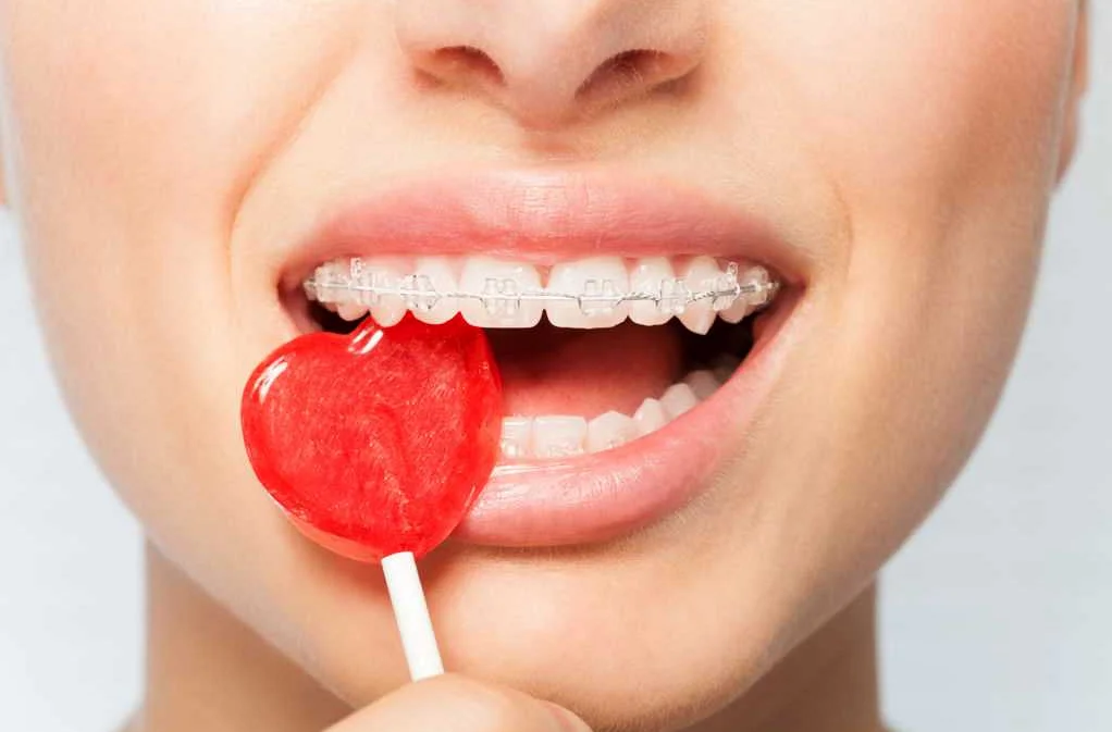 Профилактика и лечение зубного камня с целью предотвращения сердечно-сосудистых проблем