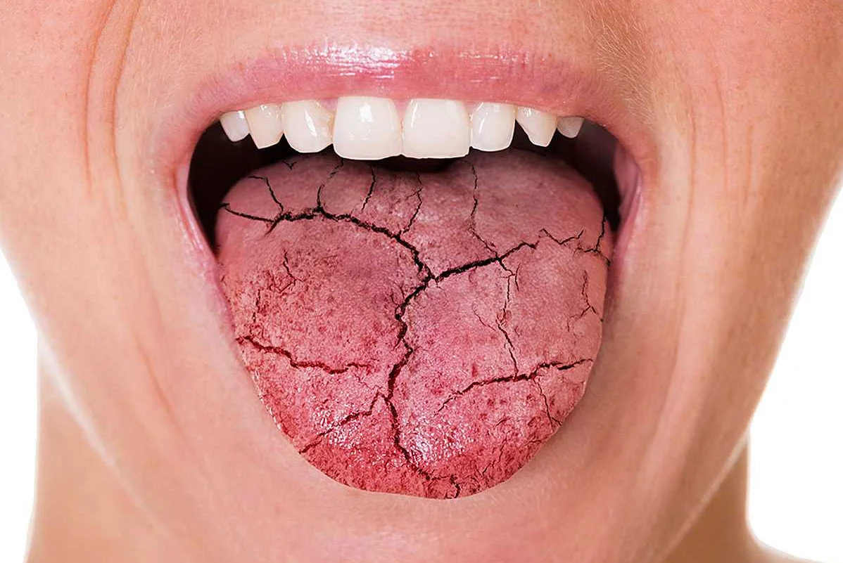 Взаимосвязь между гормонами и здоровьем полости рта