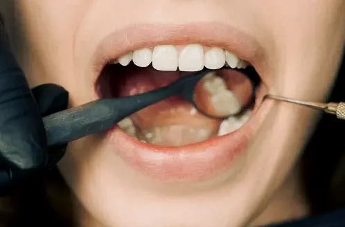 Как проверить состояние зубов и десен?