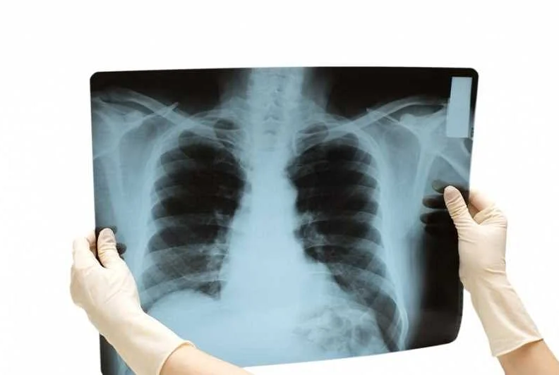 Что делать, если сомневаешься в необходимости проведения рентгеновского исследования