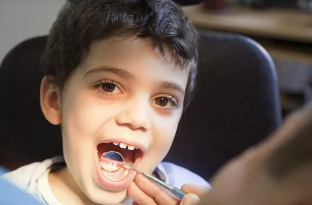 Советы для родителей по подготовке ребенка к стоматологическим процедурам