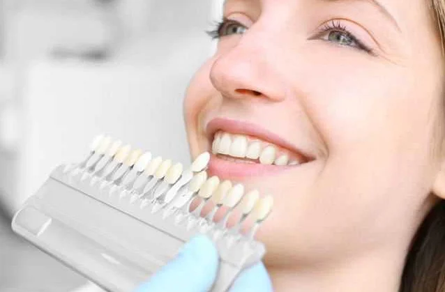 Профессиональное отбеливание зубов у стоматолога