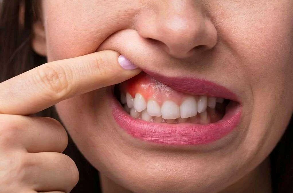 Причины возникновения связи между стоматологическими проблемами и астмой