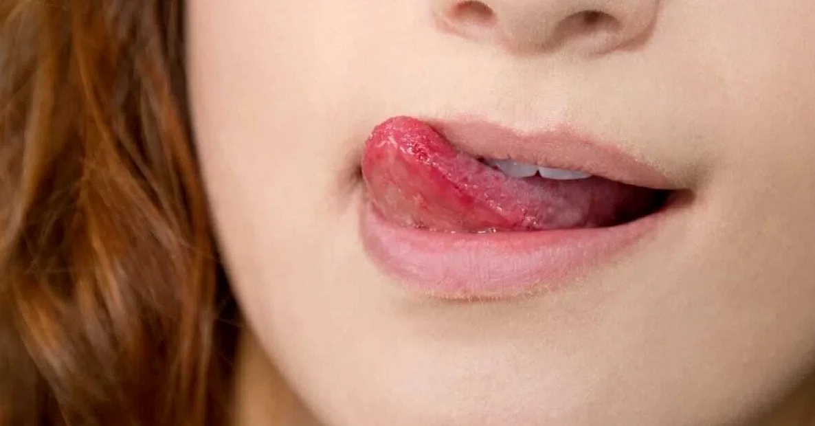 Проблемы в полости рта: причины, лечение и профилактика