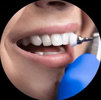 Почему профилактическая чистка зубов у стоматолога - важная процедура для поддержания здоровья ротовой полости и зубов