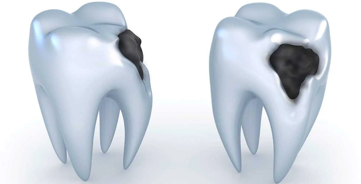Последствия неправильного питания для зубов и кожи
