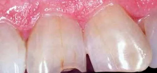 Влияние зубов на здоровье женщины