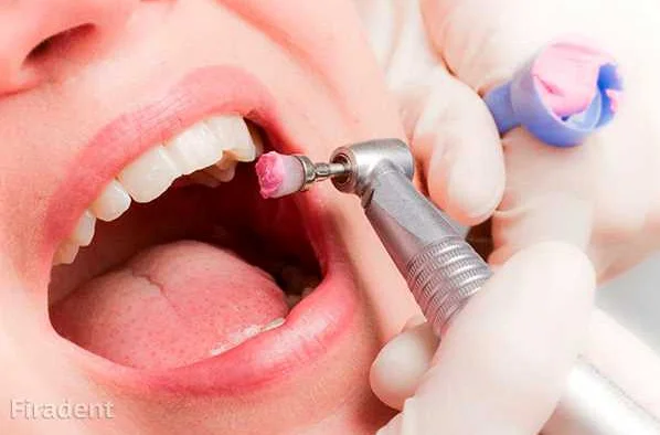 Правильная чистка зубов для здоровья ротовой полости