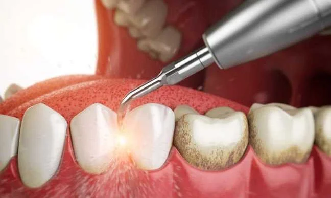 Правильная техника применения зубной нити
