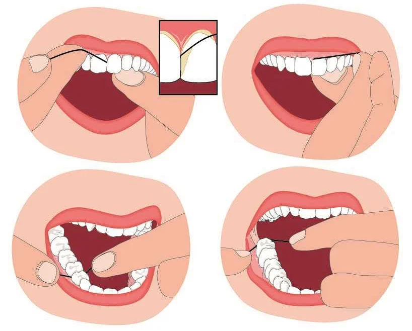 Важность зубной нити в общей гигиене полости рта