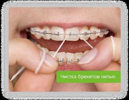 Первый шаг: Определитесь с типом зубной нити