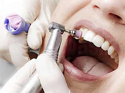 Зубная гигиена и профилактика стоматита