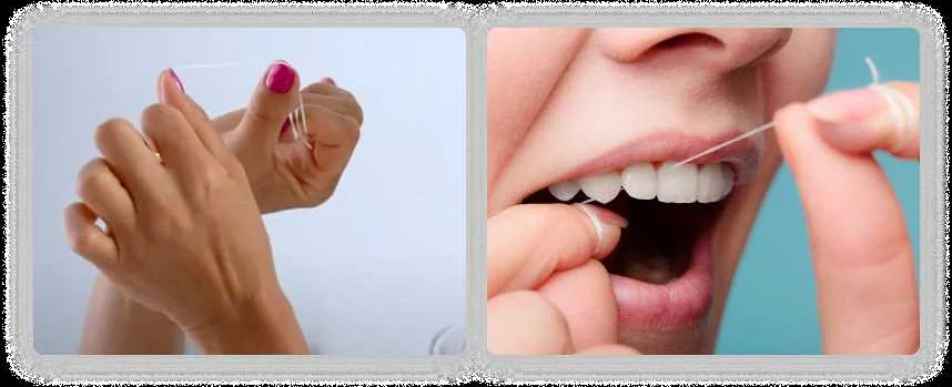 Зубная нить: как выбрать подходящий тип для разных нужд